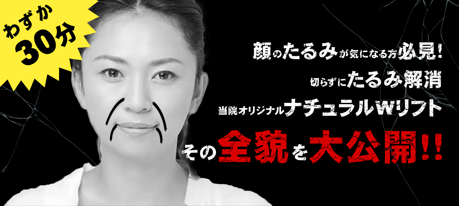 ナチュラルＷリフト